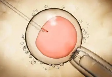 沪上生殖医学中心